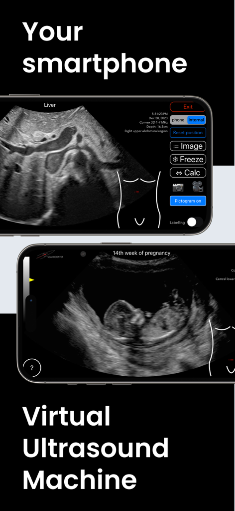 肝臓と胎児のスキャンを特徴とするスマートフォン上の仮想超音波マシンを表示するScanboosterアプリインターフェース