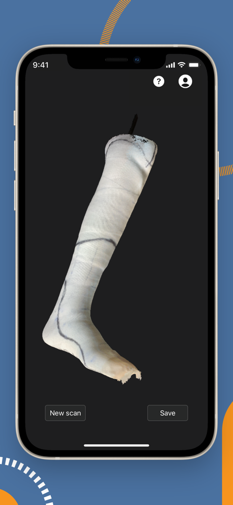 Fabtech CAD - A 3D scan of a patient's leg cast displayed on the Fabtech CAD mobile app interface.