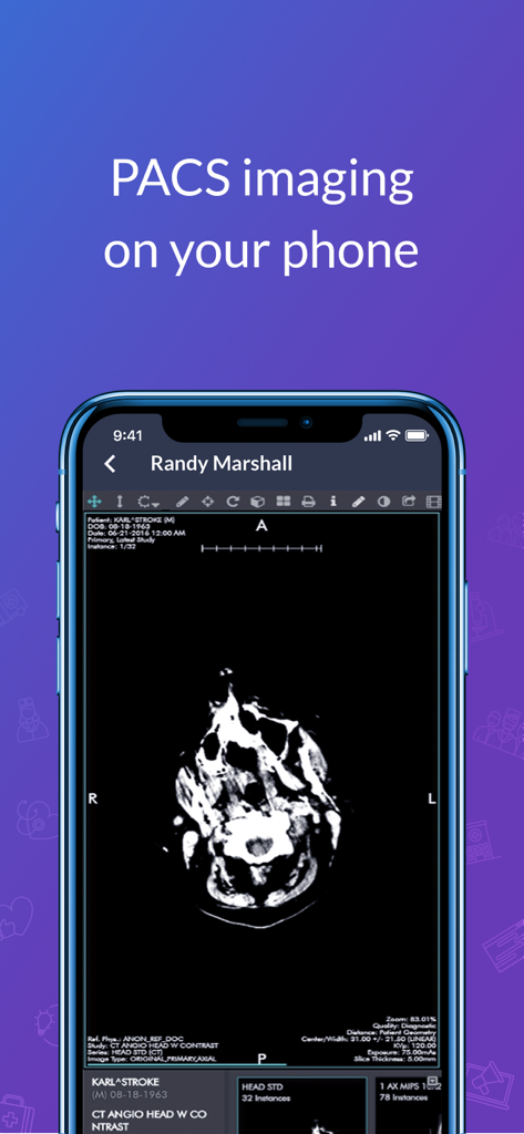 AW Touchpoint - A medical professional viewing a head CT scan on a smartphone using the AW Touchpoint PACS imaging feature