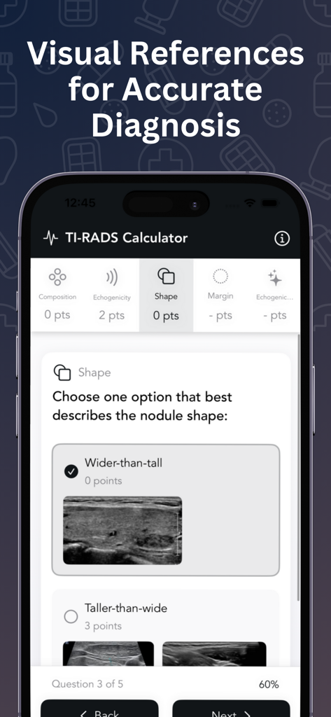 Easy TI-RADS Calculator interface showing thyroid nodule shape assessment with visual ultrasound references.
