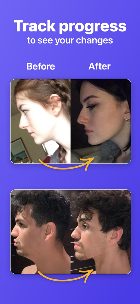 Before and after side profile photos showing jawline improvement results in the app