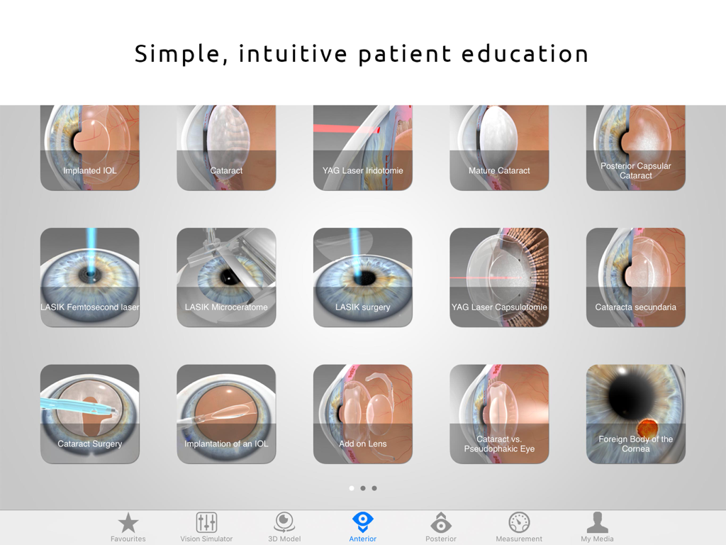 Interface of the Easy Eye app showing a library of educational images for eye conditions and surgeries like LASIK and cataracts.