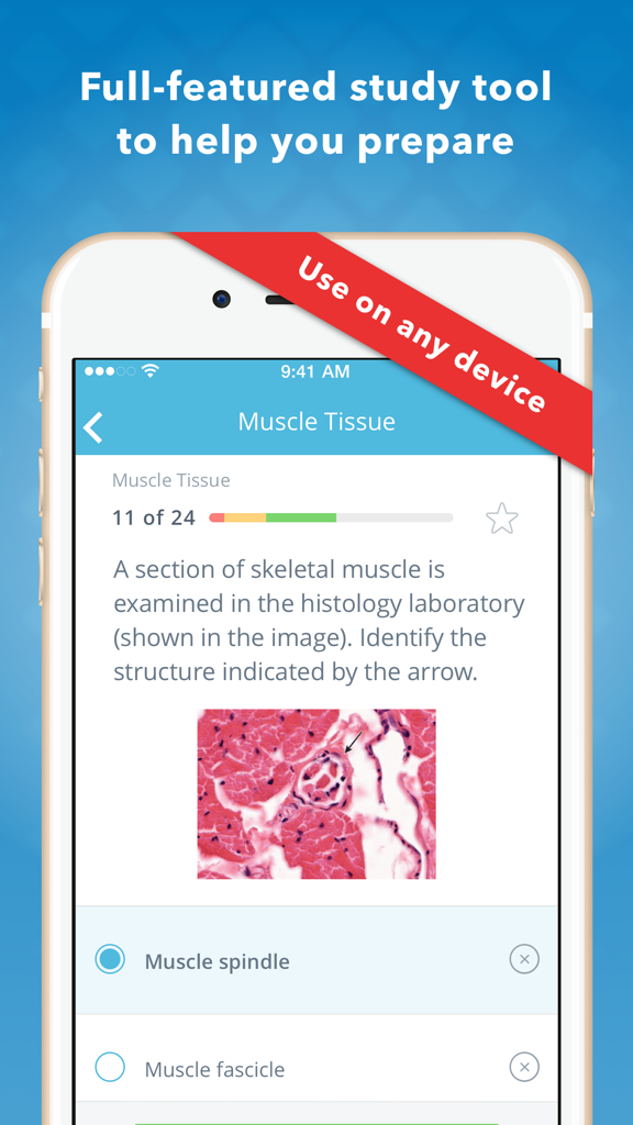 Mobile app interface showing a histology review question on muscle tissue with a microscopic slide image.