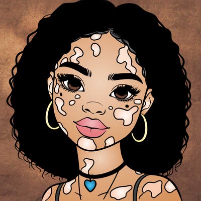 bleautiful black girl with vitiligo