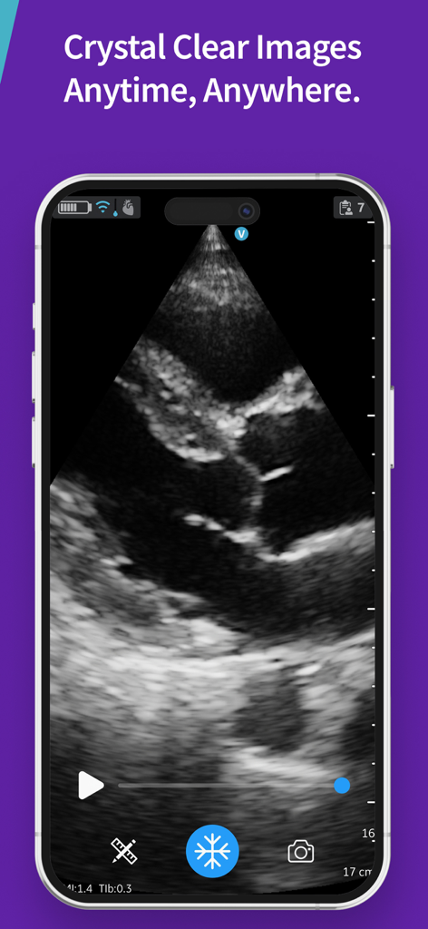Escaneo de ecografía cardíaca de alta definición mostrado en la pantalla de un smartphone usando la aplicación Vscan Air