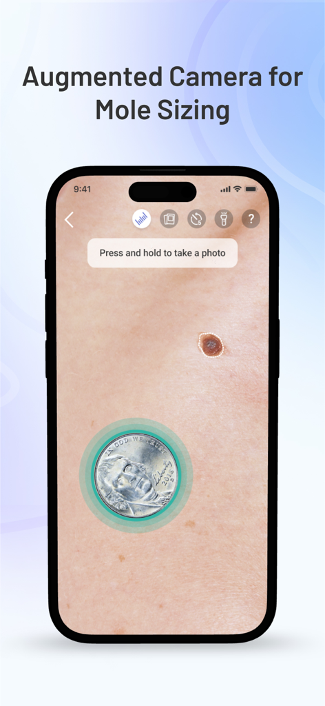 Miiskin: Rx Dermatology Visits - Miiskin app augmented camera for skin mole sizing using a US coin for reference