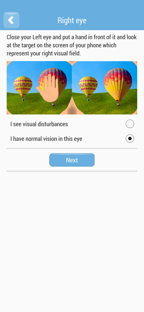 片頭痛オーラアプリの画面。右目の視野検査が表示され、視覚障害または正常な視力を報告するオプションがあります。