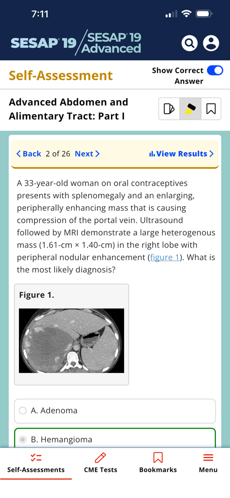 ACS SESAP 19 - Clinical case study and medical imaging on the ACS SESAP 19 self-assessment app screen.