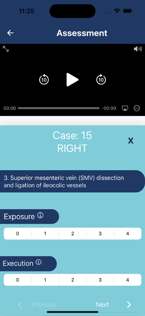 SQA App - SQA App mobile interface showing a surgical video assessment screen with rating scales for Exposure and Execution during a superior mesenteric vein dissection procedure.