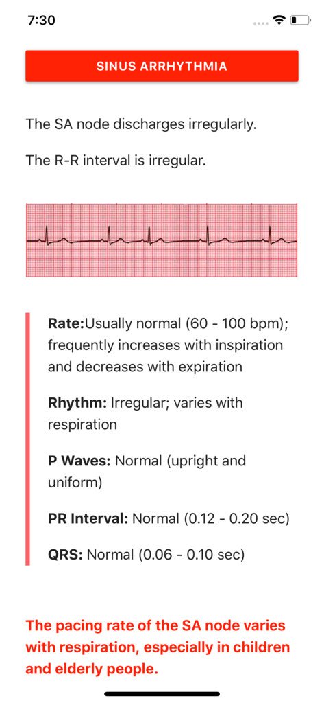 ECG FlashCards - ECG FlashCards app display for sinus arrhythmia featuring a Lead II rhythm strip and clinical diagnostic criteria