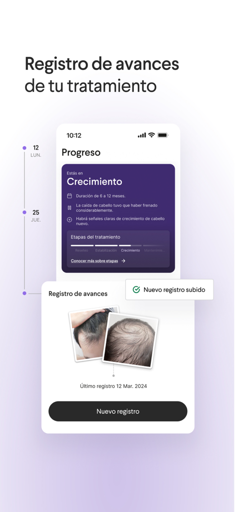 Choiz - Interfaz de la aplicación Choiz mostrando el progreso del tratamiento de pérdida de cabello con fotos de antes y después en español.