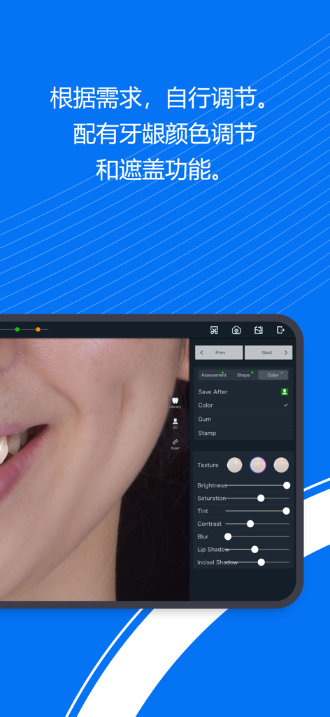 Smile Design Pro - A professional dental app interface showing color and texture adjustment tools for digital smile design.