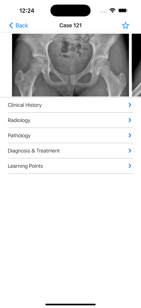BoSTT - Interface of the BoSTT medical app showing a pelvic xray and clinical case sections