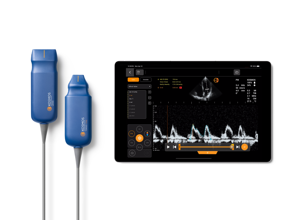 Kosmos Ultrasound 4.0 - Kosmos Ultrasound handheld probes and tablet showing cardiac imaging interface
