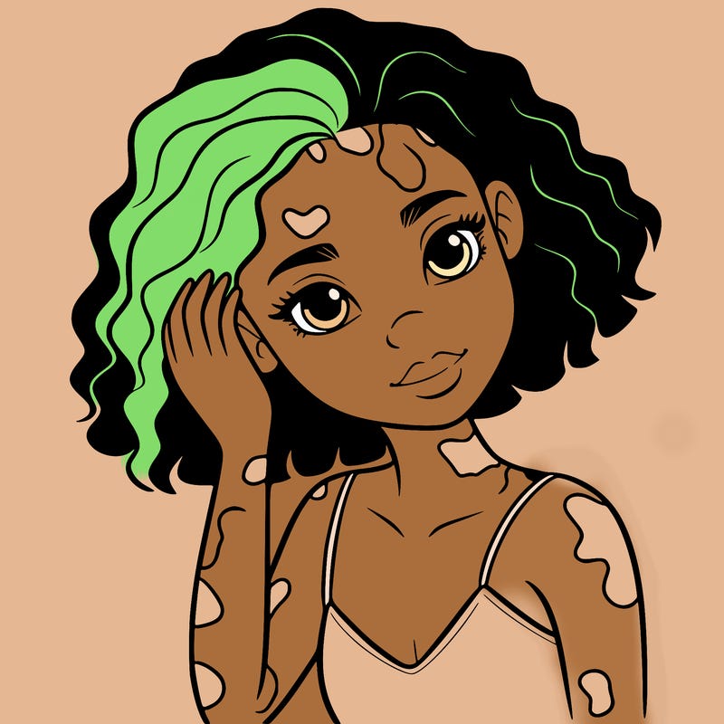 vitiligo black girl
