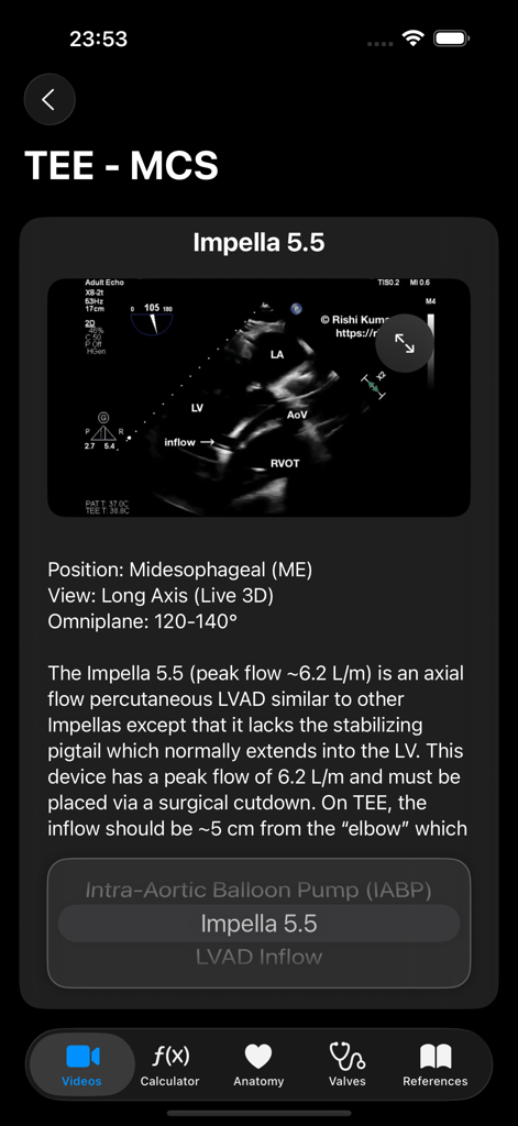 TEE midesophageal long axis view of an Impella 5.5 heart pump in the EchoRef app