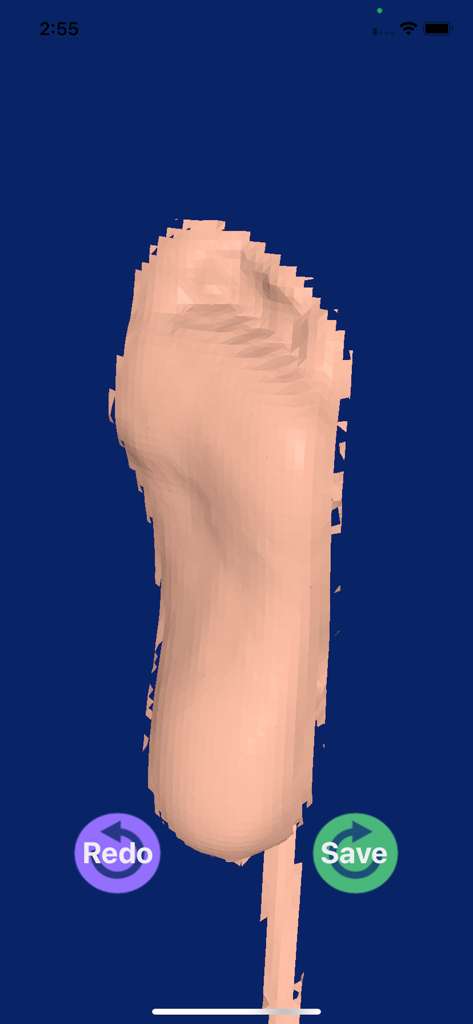 3D digital model of a foot sole scan for custom orthotics