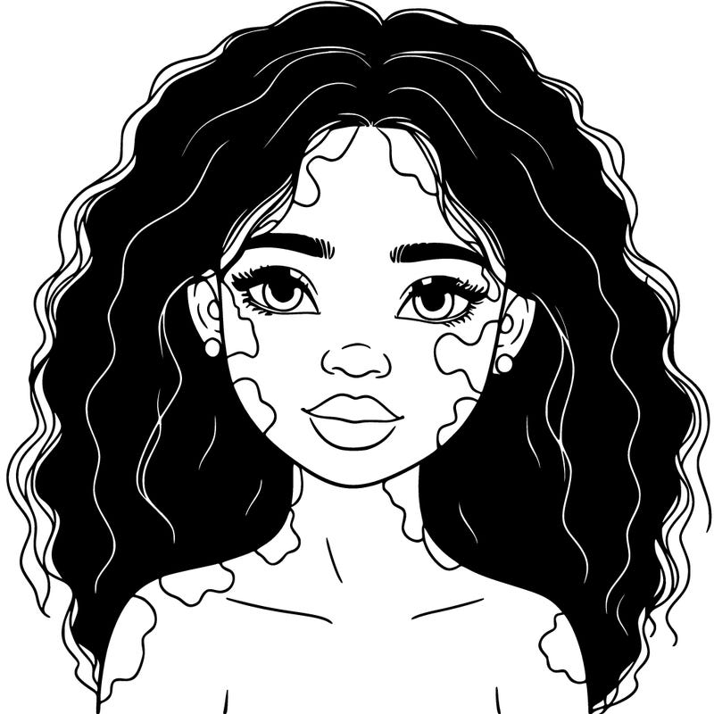 beautiful black girl with vitiligo