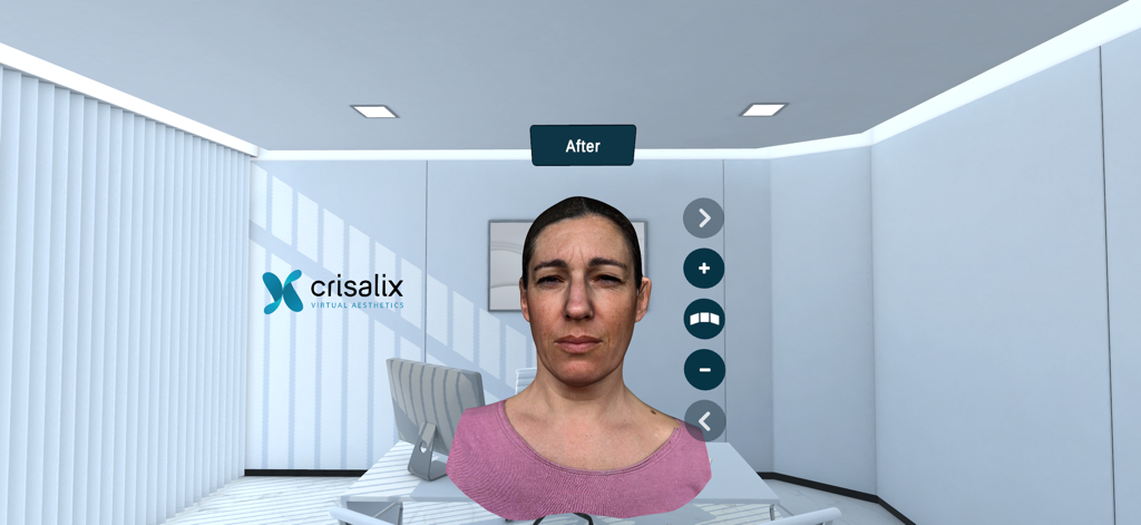 Crisalix VR - 3D facial plastic surgery simulation in a virtual reality interface