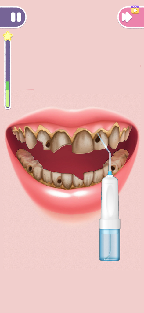 Skincare Time: Makeover ASMR - Capture d'écran du gameplay mobile montrant un processus de nettoyage dentaire ASMR avec un appareil d'hydrolavage buccal sur des dents tachées