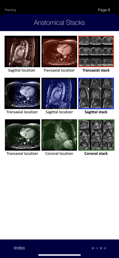 CMR Pocket Guide - CMRポケットガイドアプリに表示される、矢状断、横断、および冠状断の心血管MRI解剖学的スタックとローカライザー。