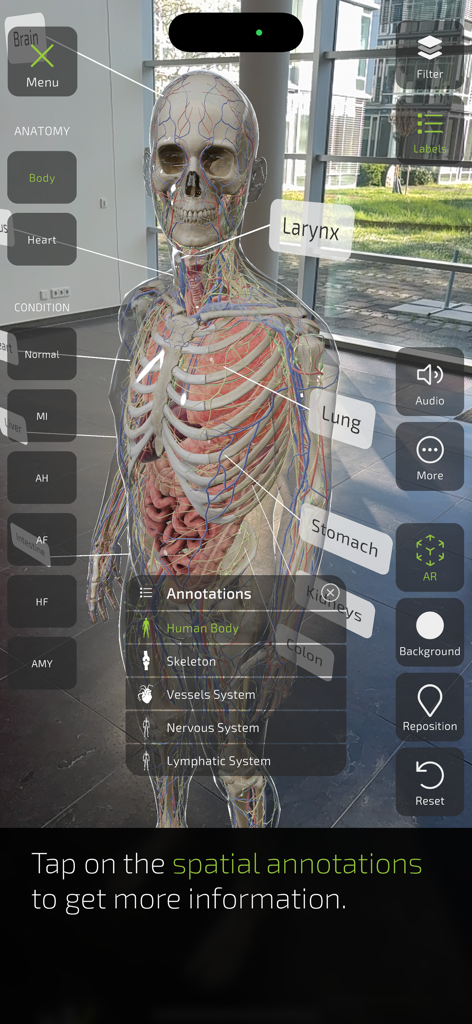 A 3D augmented reality human anatomy model in the Insight Heart app showing organs and systems with interactive spatial annotations.