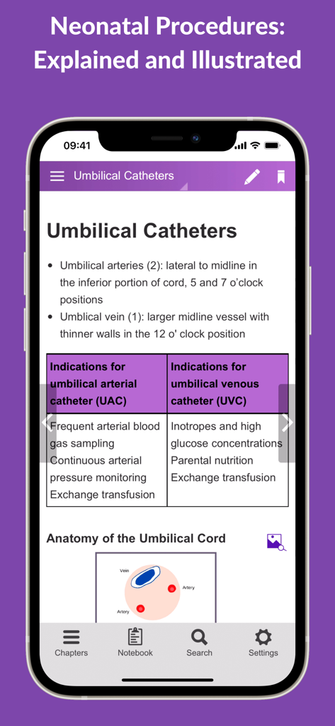 Neonatal Guide - Neonatal Guide app interface showing clinical instructions and anatomical illustrations for umbilical catheter procedures.