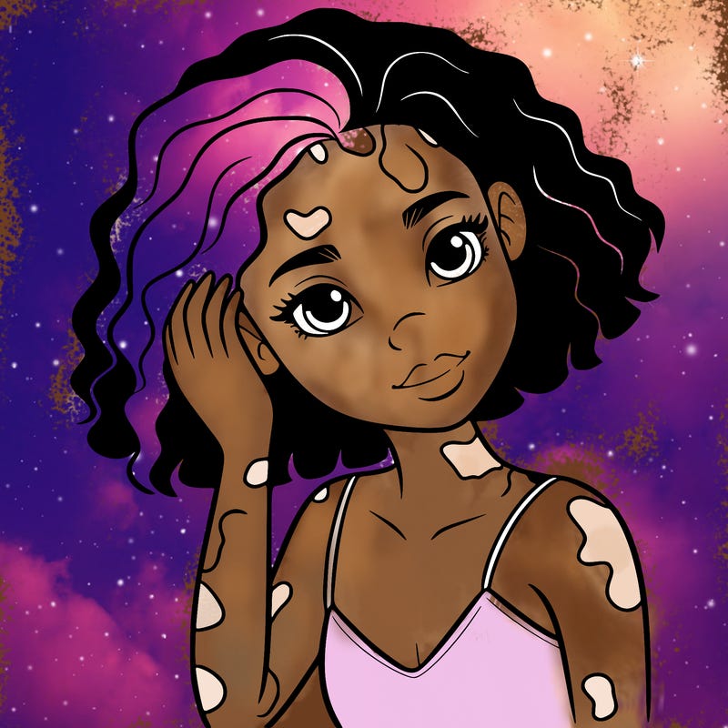 vitiligo black girl