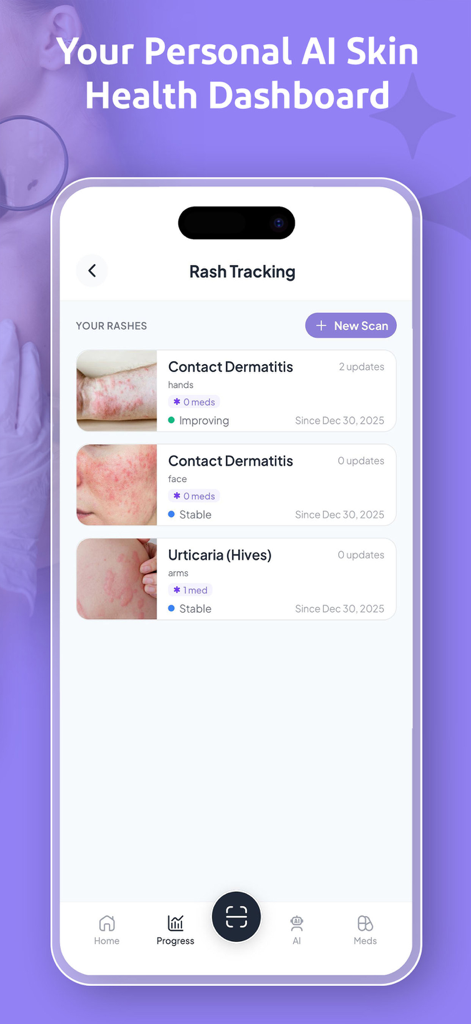 The Rash Scan app skin health dashboard displaying a history of tracked rashes and condition progress