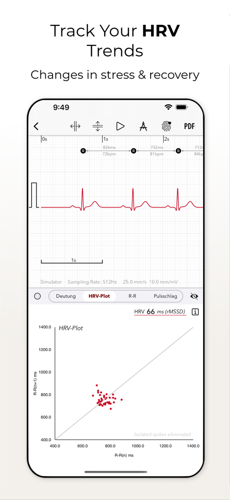 ECG+ | Your Watch ECG Reader - Smartphone screen showing ECG plus app with heart rate variability trends and HRV plot data