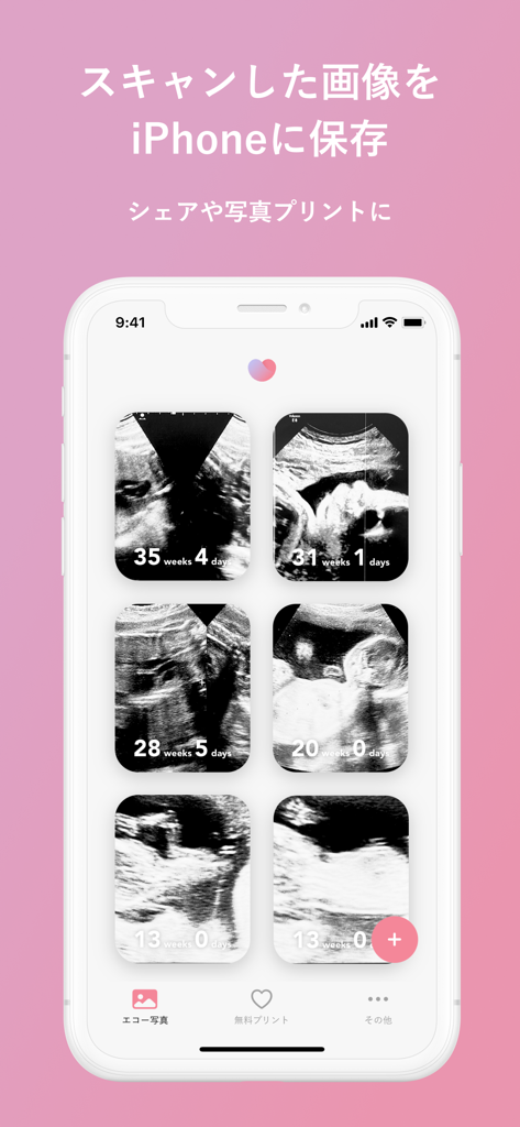 Digital gallery of scanned ultrasound photos with pregnancy week overlays.