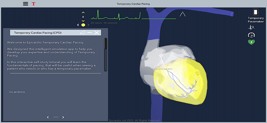 Interactive 3D heart simulation and welcome tutorial screen in the Temporary Cardiac Pacing medical app.