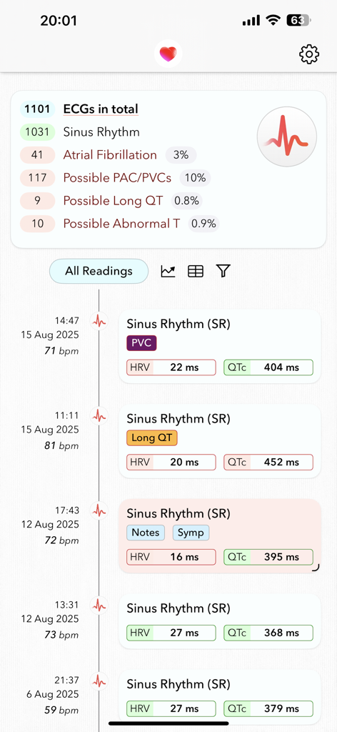 ECG+ | Your Watch ECG Reader - ECG plus app dashboard displaying a history of heart health readings and heart rate variability metrics