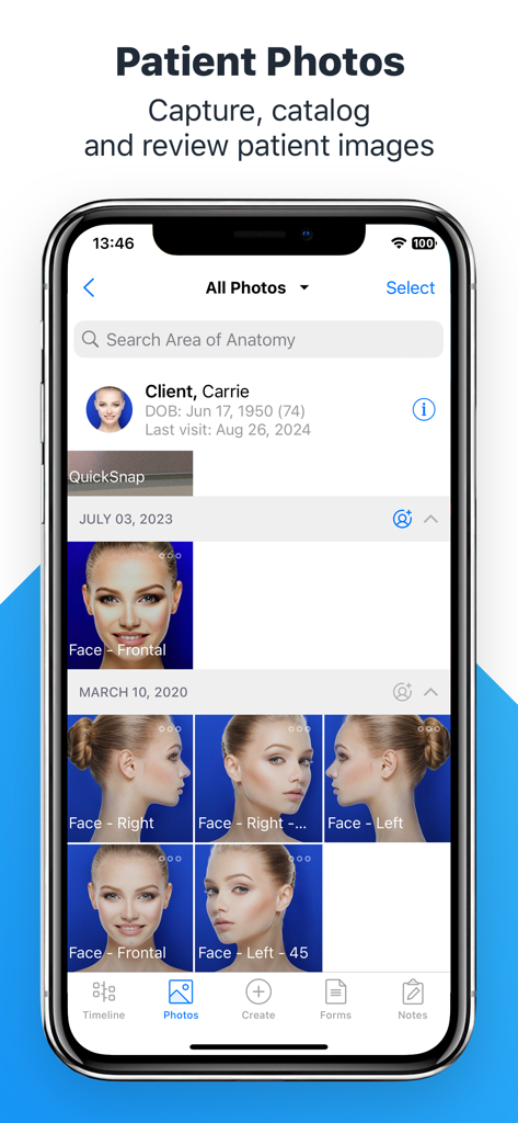 Interface do aplicativo móvel RxPhoto mostrando uma galeria organizada de fotos faciais de pacientes rotuladas por data e visão anatômica