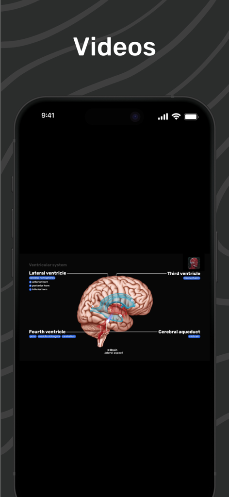 A 3D anatomy video demonstrating the human brain ventricular system with labels for the ventricles and cerebral aqueduct