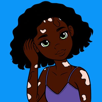 vitiligo black girl