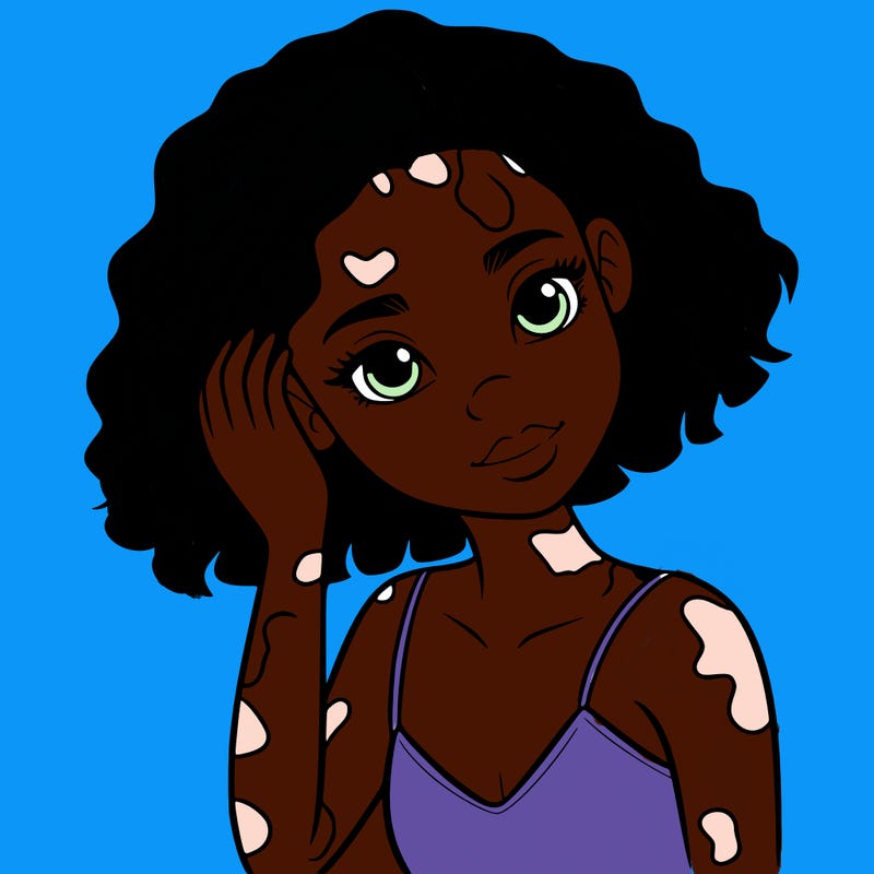 vitiligo black girl