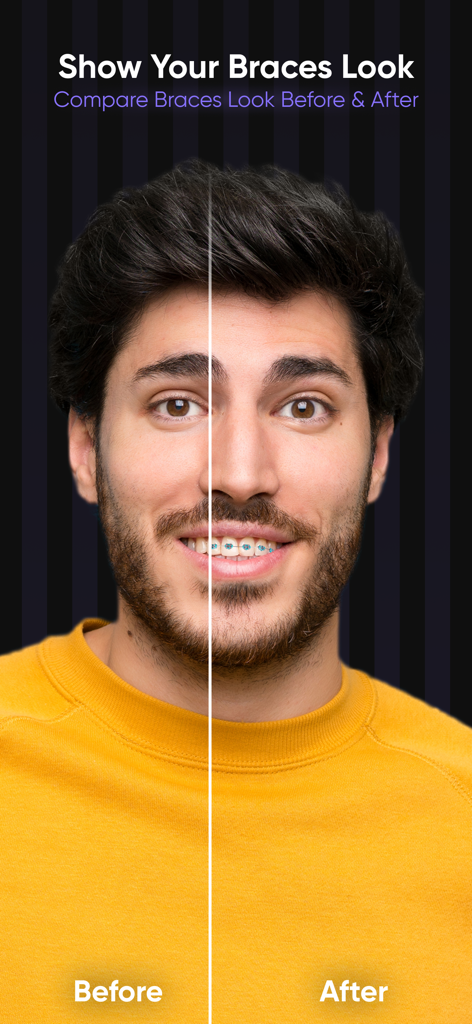 Before and after photo comparison showing virtual braces on a smile