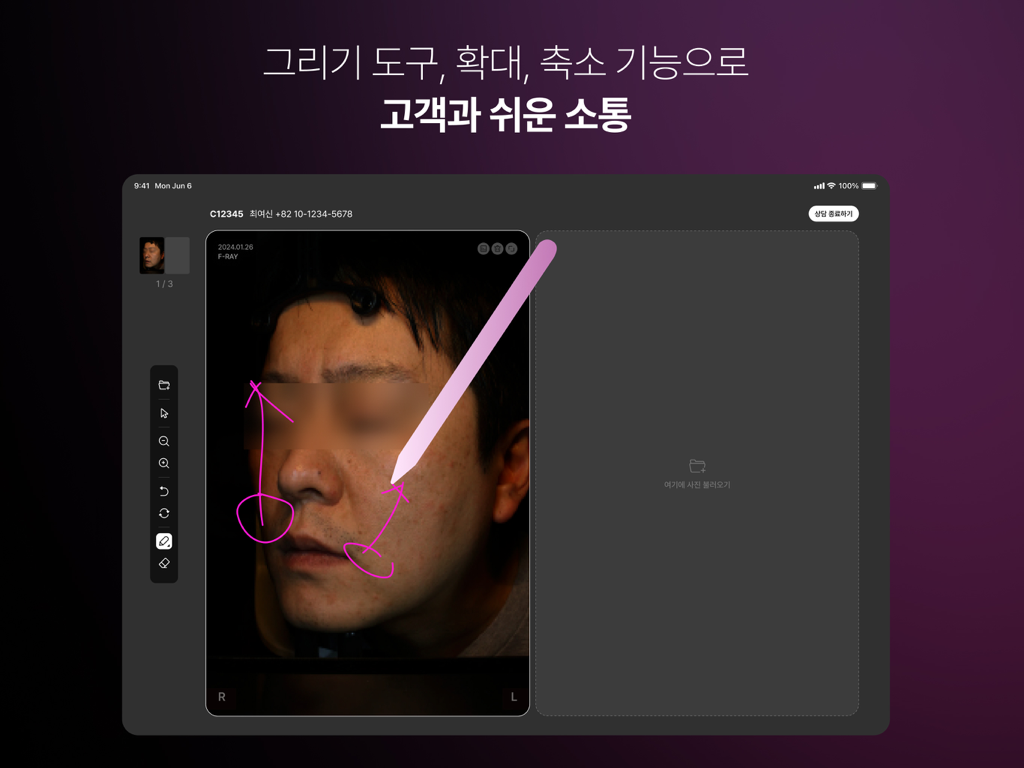 F-RAY 상담뷰어 - Medical App | MWM