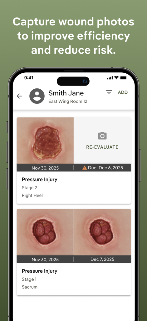 Interface do aplicativo PointClickCare ChartPic exibindo fotos de feridas e documentação para um paciente