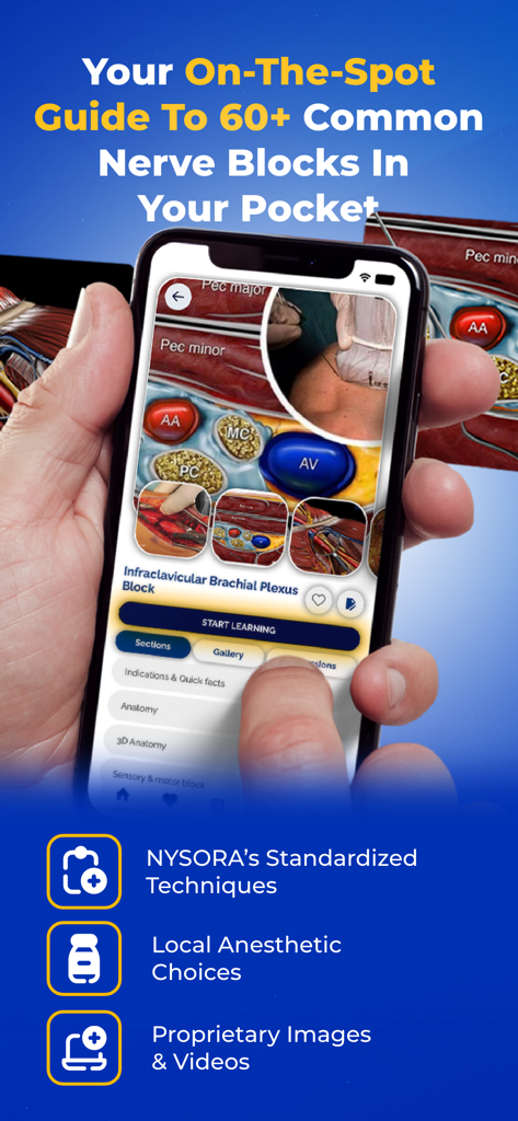 NYSORA Nerve Blocks - Smartphone displaying the NYSORA Nerve Blocks app with anatomical guides for ultrasound-guided procedures.