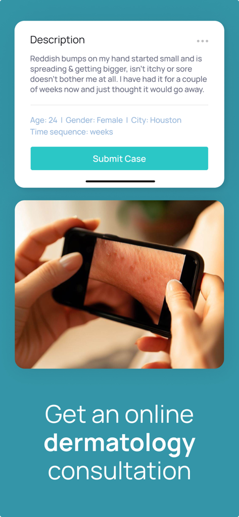 Usuario enviando detalles y foto de una preocupación de la piel para una consulta de dermatología en línea