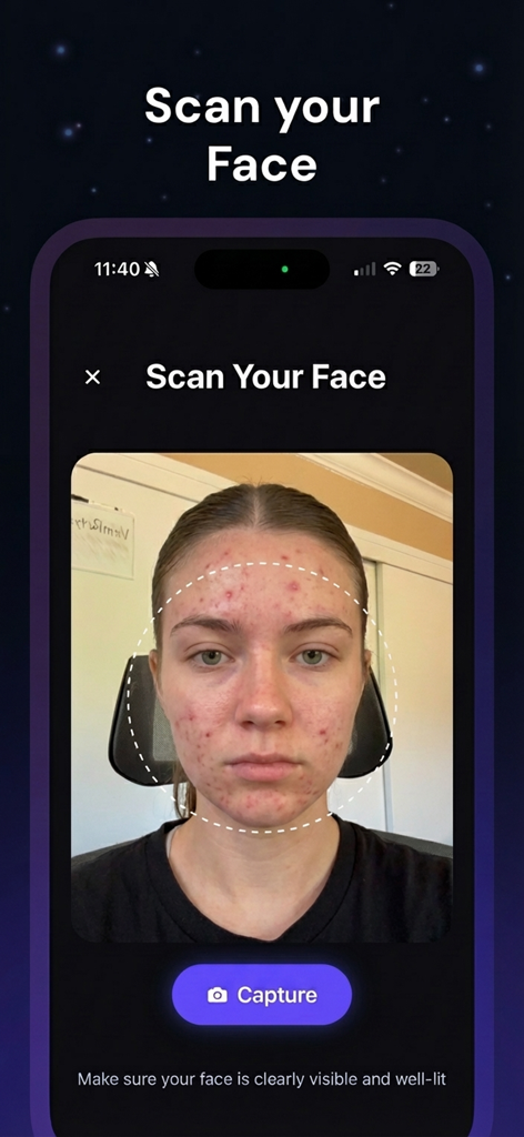 Noma - Get Rid of Acne - Interface of the Noma app showing a user alignment for an AI face scan to analyze acne