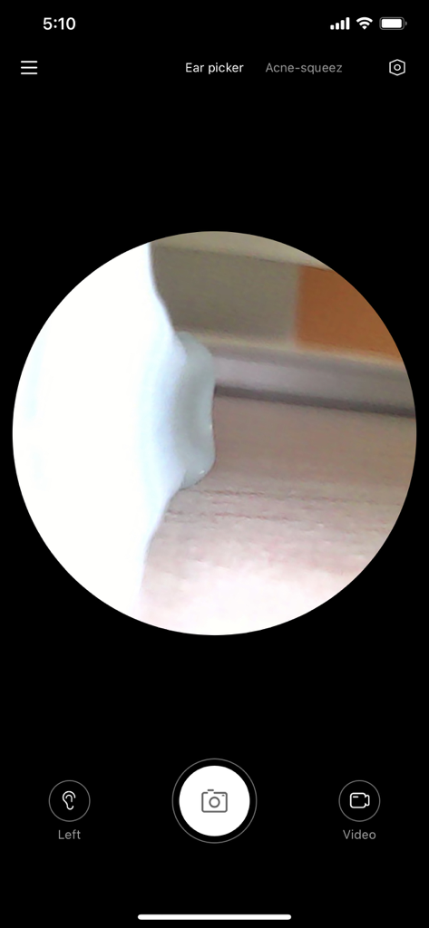 Xlife - Xlifeアプリのスクリーンショット。スマート耳掃除カメラからの円形のライブビデオフィードが表示され、カメラとビデオコントロールボタンが付いています