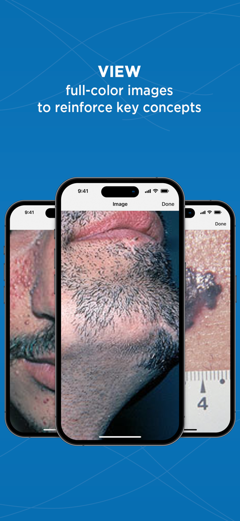 Medicine Central - Full color clinical dermatology images in the Medicine Central app