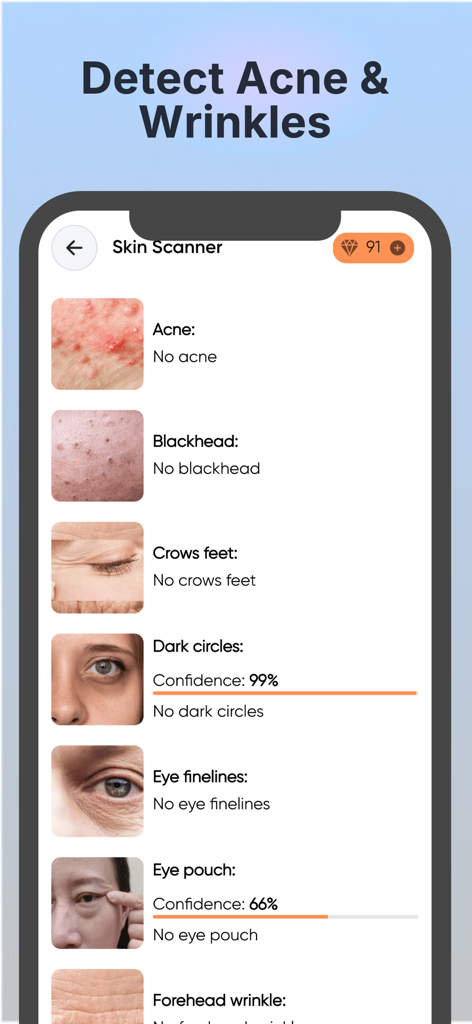 SkinBot AI Skin Care - Interface of SkinBot AI app showing skin scanner results for acne wrinkles and dark circles with confidence percentages
