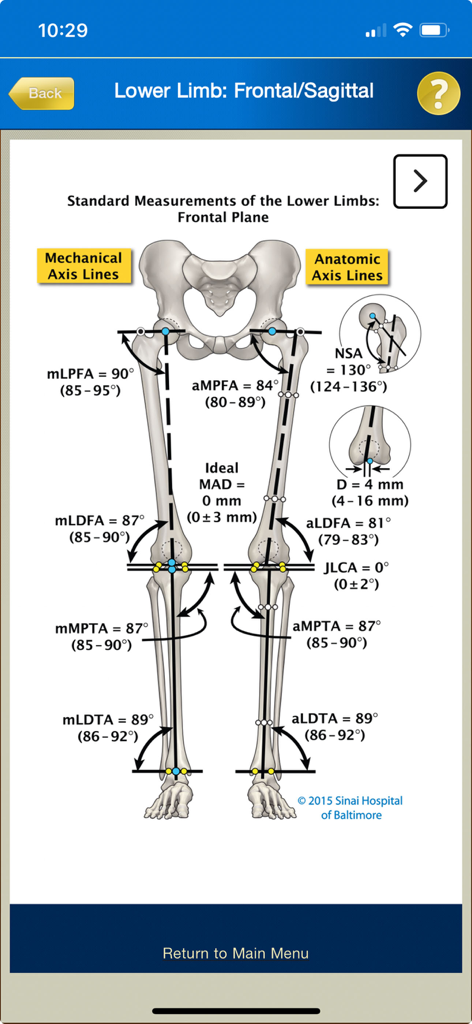 Multiplier - Orthopedic diagram of lower limb standard measurements and axis lines in the frontal plane