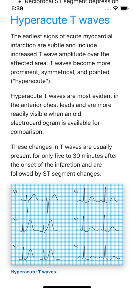ECG Basics Lite: ECG Made Easy - Medical App | MWM