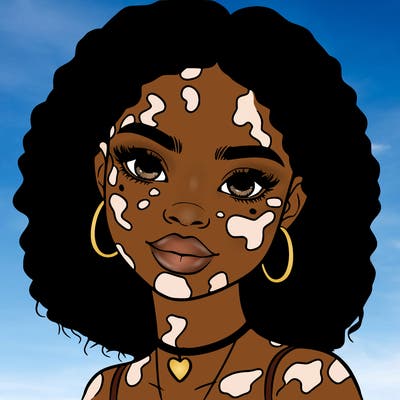 bleautiful black girl with vitiligo