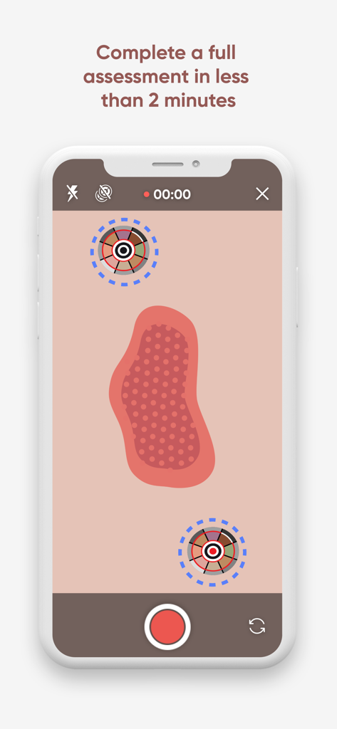 Minuteful for Wound - Minuteful for Wound app interface showing a wound scan with calibration stickers for quick clinical assessment